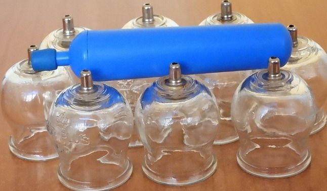 Zestaw bezogniowych baniek lekarskich z niebieską pompką na drewnianym stole. Bańki szklane, bezbarwne, z metalowymi elementami. Alternatywna metoda leczenia.