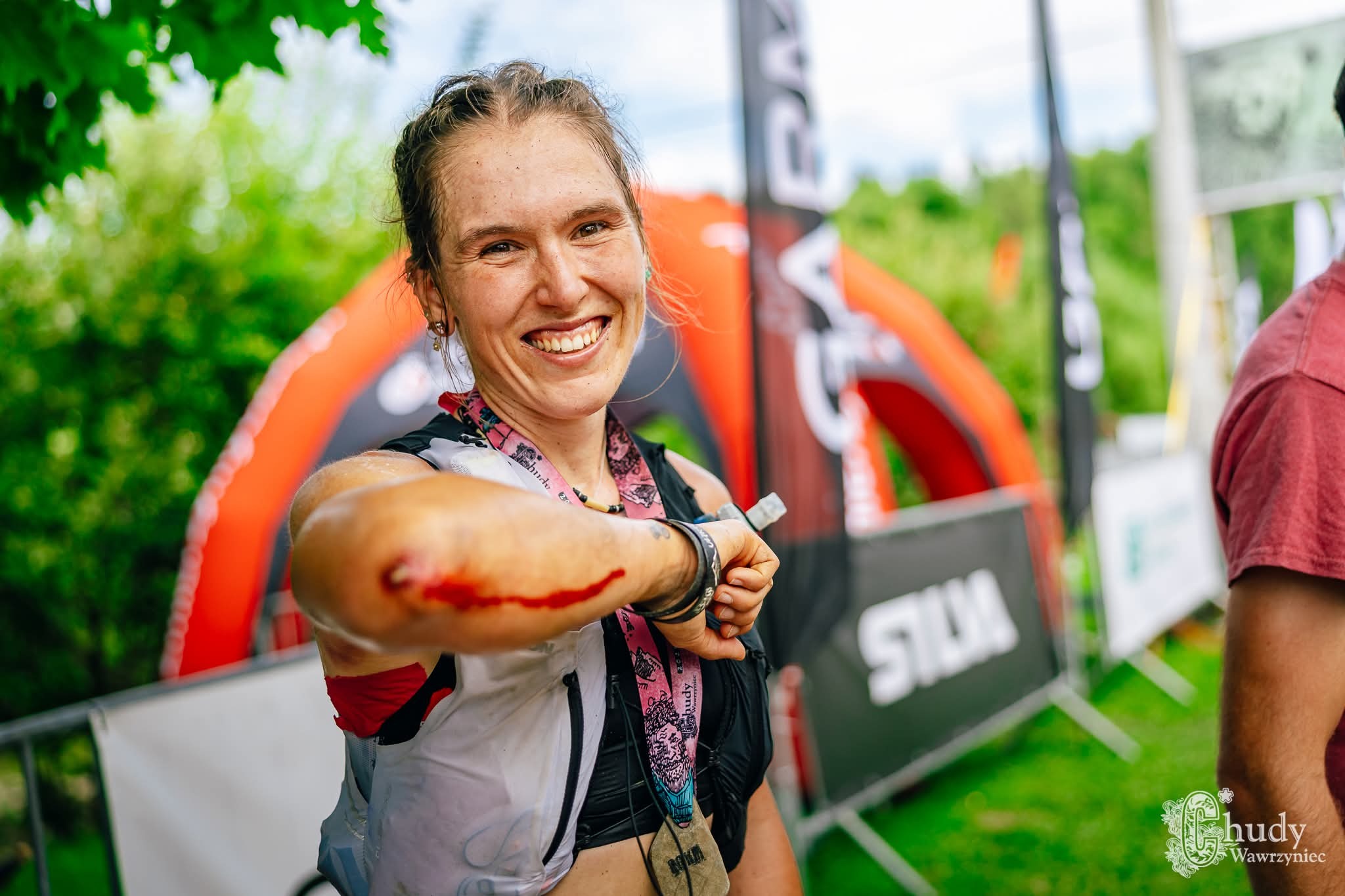 Uśmiechnięta kobieta po biegu z otarciem na ramieniu, w sportowym stroju, z medalem na szyi, na tle zieleni i mety.