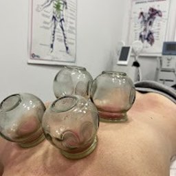 Manufaktura Zdrowia - Fizjoterapia - Masaż - Akupunktura - Szklane bańki na plecach pacjenta, widoczne zaczerwienienia skóry. W tle plakat z układem mięśniowym i sprzęt medyczny. Zabieg w gabinecie.