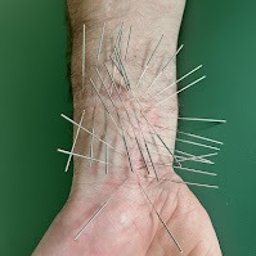Manufaktura Zdrowia - Fizjoterapia - Masaż - Akupunktura - Akupunktura nadgarstka: cienkie igły wbite w skórę, widoczne włosy na ręce, zielone tło. Bliski kadr na dłoń podczas zabiegu.