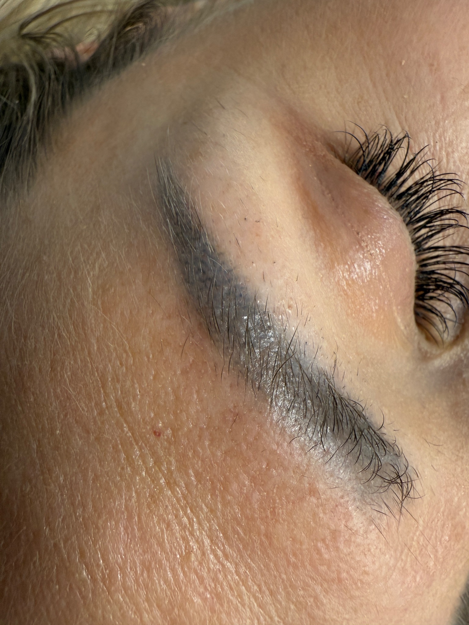 Usuwanie makijażu permanentnego - Laser, Remover