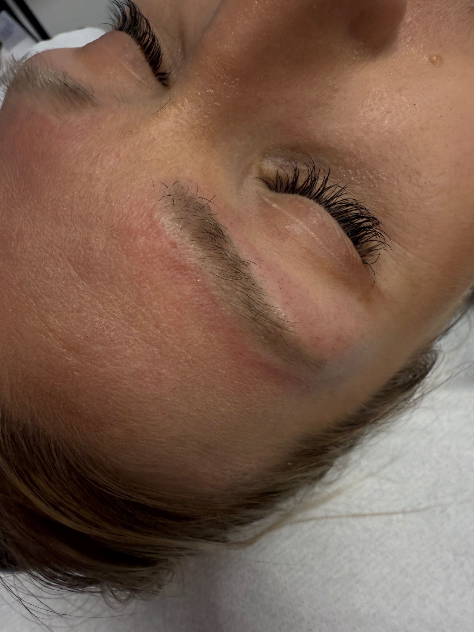 Zbliżenie na twarz kobiety po zabiegu kosmetycznym, widoczne podkreślone brwi i rzęsy, skóra lekko zaczerwieniona, ujęcie z góry.