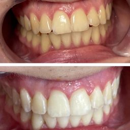 Medycyna estetyczna Racibórz 1