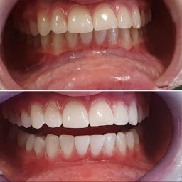 Medycyna estetyczna Racibórz 2