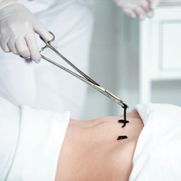 Biomed Przychodnia Rehabilitacyjno-Lecznicza - hirudoterapia