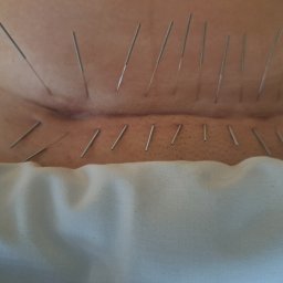 Fizjoterapeuta Postołów 2