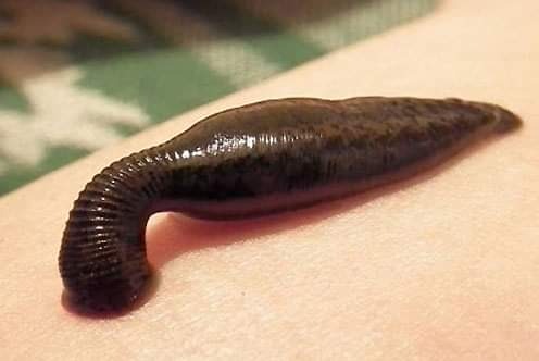 Zbliżenie pijawki lekarskiej na skórze, widoczne segmenty ciała i przyssawka, w tle fragment zielonego materiału. Specyficzne ujęcie makro, podkreślające detale.