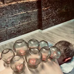 Mężczyzna leży na brzuchu z bańkami próżniowymi na plecach. Widoczny fragment ściany z fototapetą przedstawiającą leśną ścieżkę. Zabieg akupunktury.