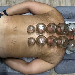 Fizjoterapeuta Wojciechów 2