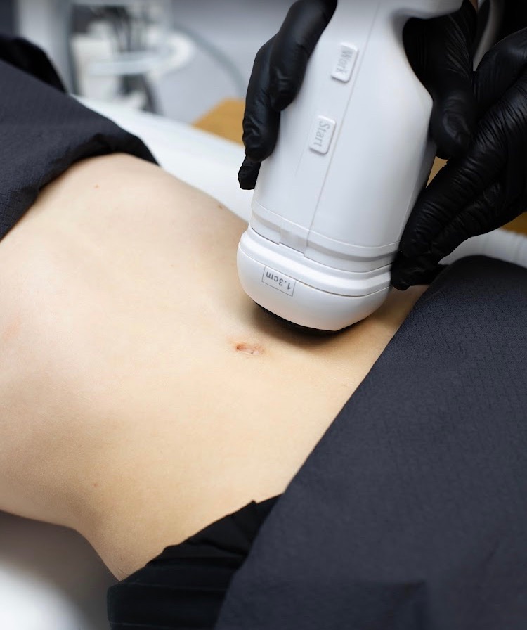 Zabieg na brzuchu pacjenta wykonywany urządzeniem kosmetycznym przez osobę w czarnych rękawiczkach. Widoczne przyciski 'Start' i 'Work' na urządzeniu.