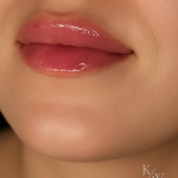 klaudia wolska kosmetologia bydgoscz powiększanie ust