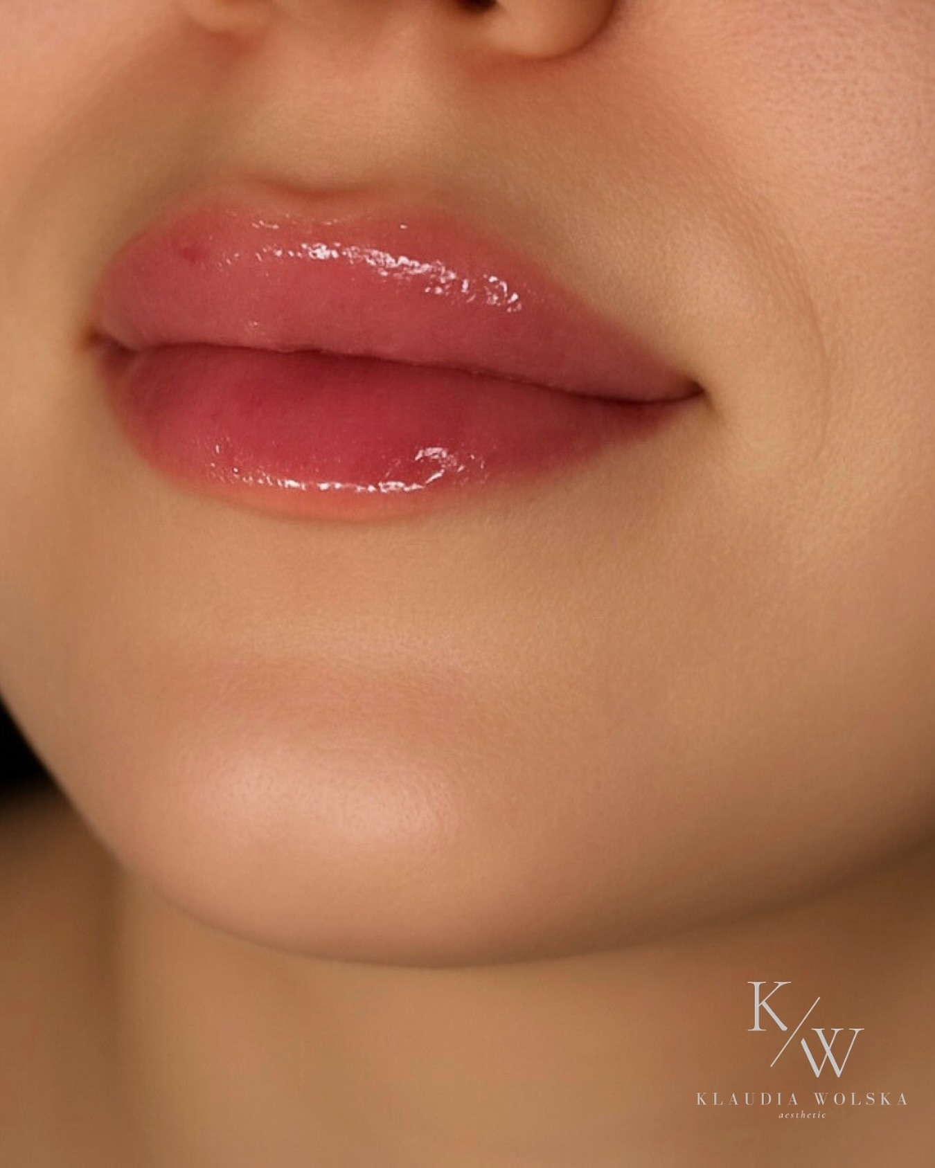 klaudia wolska kosmetologia bydgoscz powiększanie ust