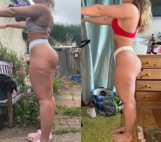 Kolaż: metamorfoza sylwetki kobiety, widok z boku. Po lewej: figura przed, po prawej: figura po. Widoczne zmiany w kształcie pośladków i ud.