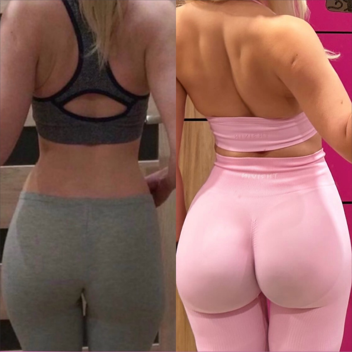 Zdjęcie typu 'przed i po' prezentujące metamorfozę sylwetki kobiety, z wyraźną różnicą w kształcie pośladków, ukazane od tyłu, w sportowej bieliźnie.