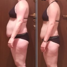 Utrata tkanki tłuszczowej, redukcja, ujędrnienie