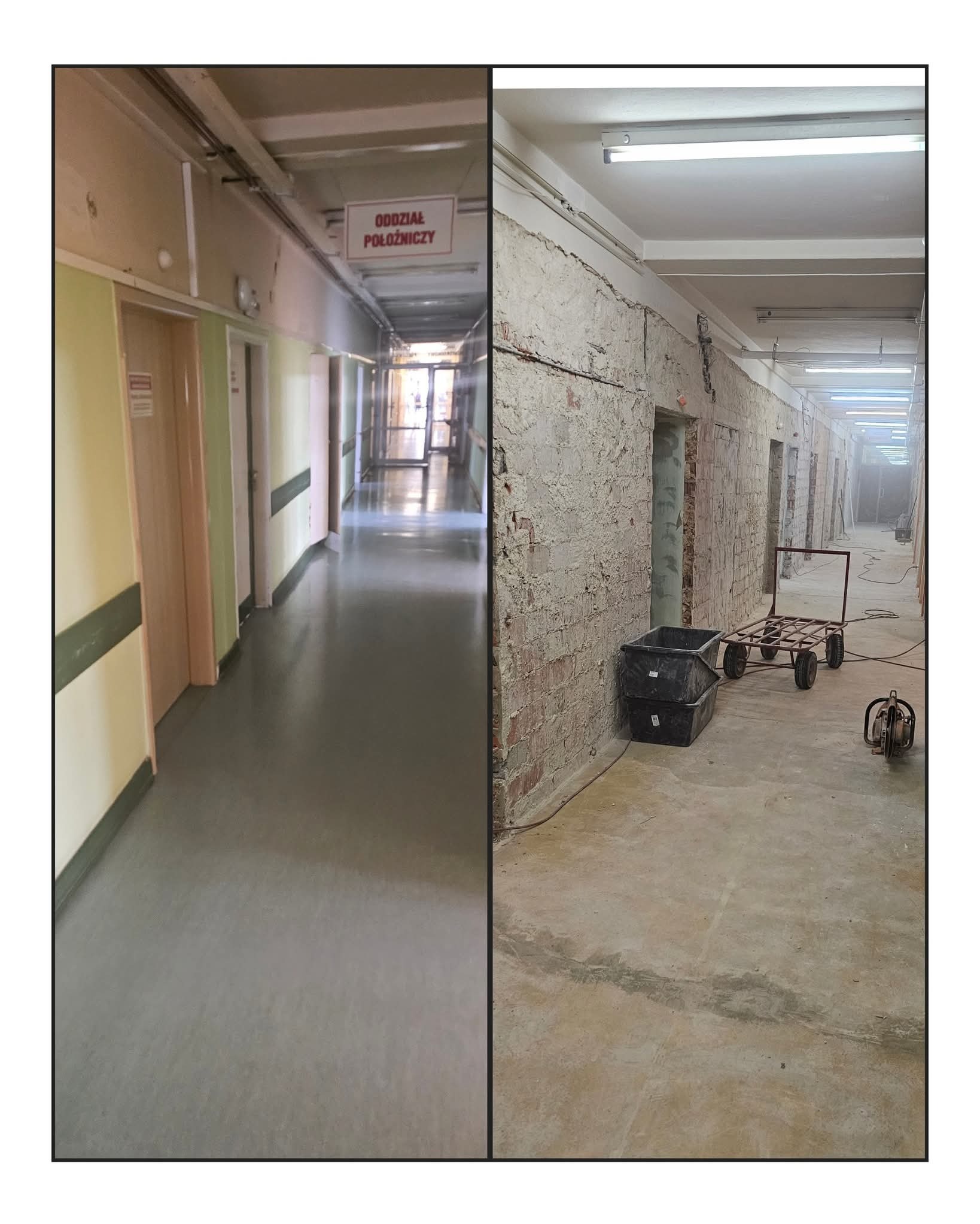 Zdjęcie 'przed i po' rozbiórki ścian w korytarzu szpitalnym w Pruszkowie. Po lewej stan pierwotny, po prawej ściany z cegły po usunięciu tynku, widoczne narzędzia.