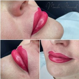 Depilacja laserowa Świebodzin 2