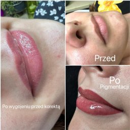 Depilacja laserowa Świebodzin 3