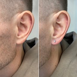 Gentle Piercing - Ucho mężczyzny przed i po przekłuciu z małym, błyszczącym kolczykiem. Widoczne zaczerwienienie skóry po zabiegu. Ujęcie z bliska, skupione na detalu.