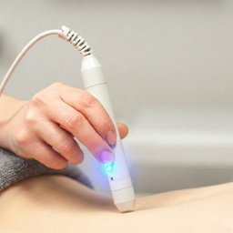 Kinesis Kraków - Rehabilitacja - Laseroterapia: dłoń terapeuty aplikuje laser na skórę pacjenta. Widoczny biały laser z niebieskim światłem, kabel i fragment ciała pacjenta na szarym tle.