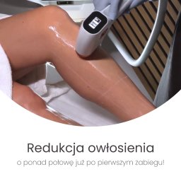 ARWIT ENTERPRISE SPÓŁKA Z OGRANICZONĄ ODPOWIEDZIALNOŚCIĄ - Noga klienta smarowana żelem, poddawana zabiegowi depilacji laserowej. Biały aplikator lasera w dłoni w rękawicy. Widoczny ekran urządzenia.