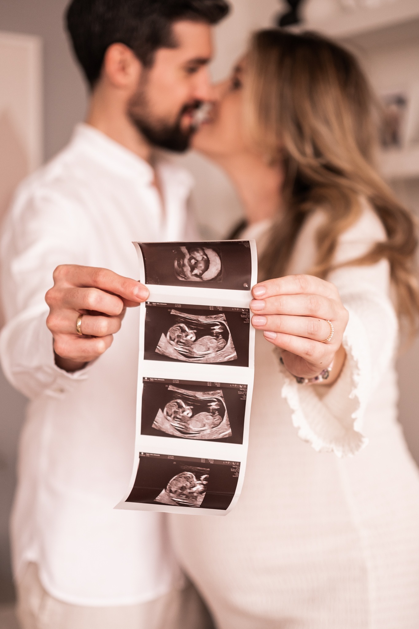 Uśmiechnięta para w bieli trzymająca serię zdjęć USG płodu, z delikatnym efektem bokeh na twarzach, podkreślającym intymność i radość oczekiwania.