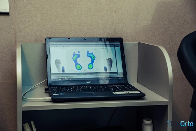 Laptop z analizą rozkładu nacisku stóp w Warszawie. Widoczne skany stóp na ekranie, ustawiony na białym regale. Diagnostyka w gabinecie.