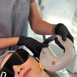 Laserowe odmładzanie skóry, usuwanie przebarwień i zmarszczek Kraków - gabinet kosmetyczny My Body Clinic Podgórze