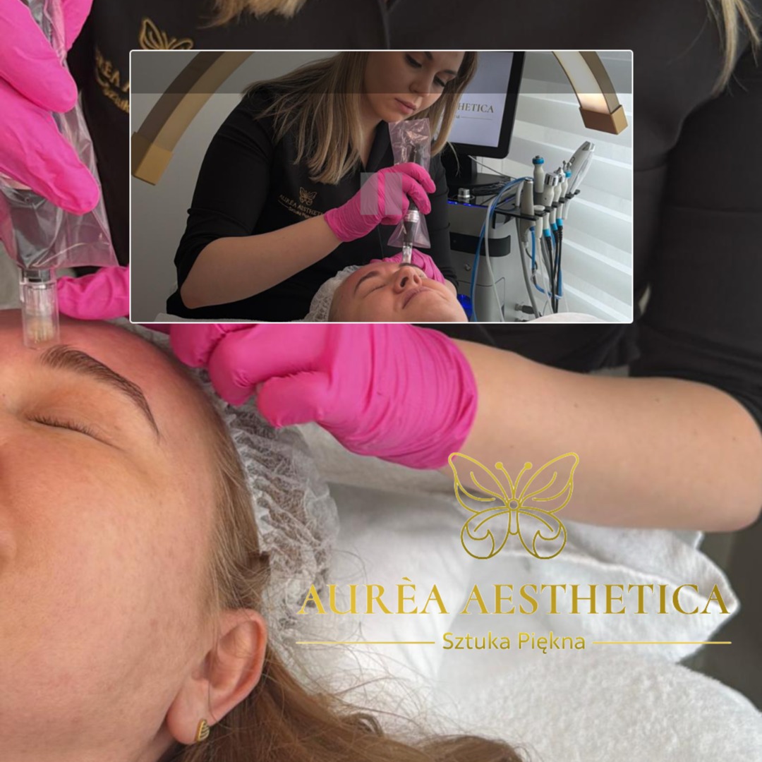 Zabieg mezoterapii mikroigłowej na twarzy klientki w salonie. Kosmetolog w różowych rękawiczkach wykonuje precyzyjne nakłucia. Widoczna aparatura i logo salonu.