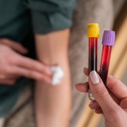 FIRST CARE - Pobieranie krwi w domu: dwie próbówki z krwią w dłoni, w tle ramię pacjenta dezynfekowane wacikiem. Żółta i fioletowa zatyczka probówek.