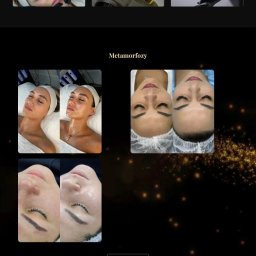 Verelumiere - Zrzut ekranu nowoczesnej strony internetowej salonu beauty z Gorzowa Wielkopolskiego, prezentującej usługi, sprzęt i efekty zabiegów na twarz w sekcji 'Metamorfozy'.
