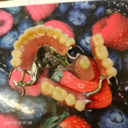 Wyjmowana proteza szkieletowa z metalowymi klamrami, leżąca na tle z motywem truskawek i jagód.